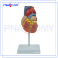 PNT-0400 Atherosclerosis Plastic Human Heart Model For Medical Teaching